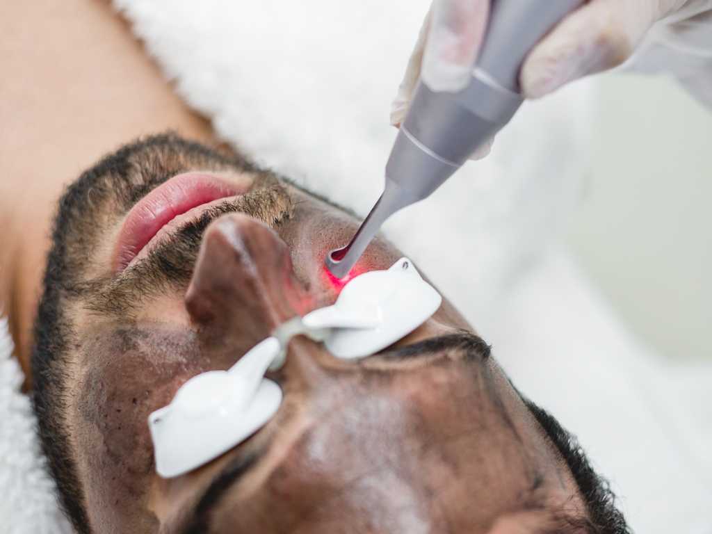 hollywood peel en hombre